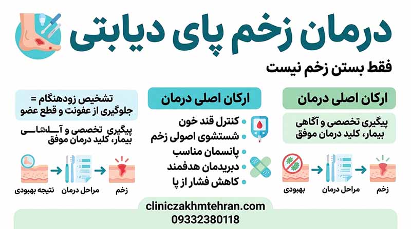 درمان زخم پای دیابتی درمان زخم پای دیابتی