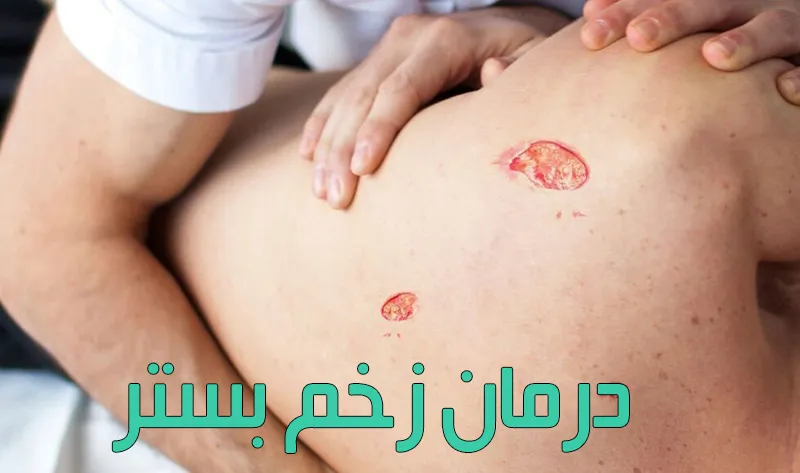 زخم-بستر-درمان