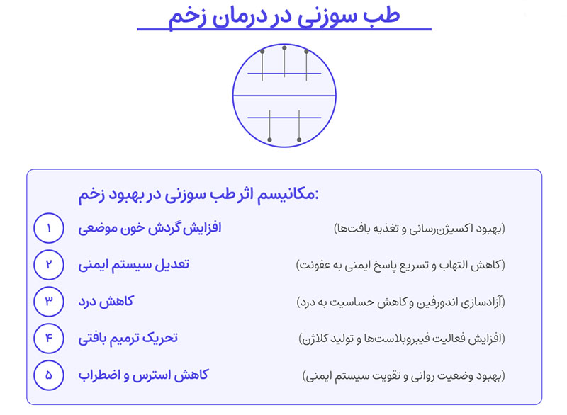 طب سوزنی در درمان زخم