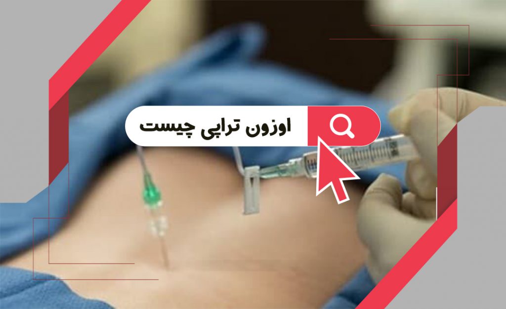 اوزون تراپی زخم چیست؟ اوزون تراپی زخم چیست؟