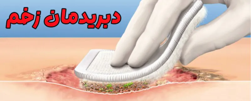 دبریدمان زخم