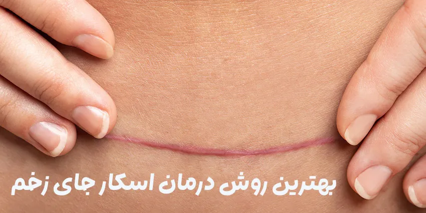 اسکار-زخم