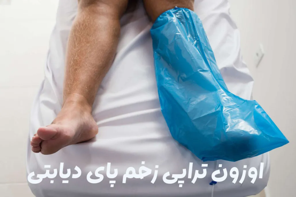 اوزون-تراپی-زخم-دیابتی