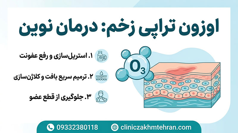 اوزون تراپی زخم