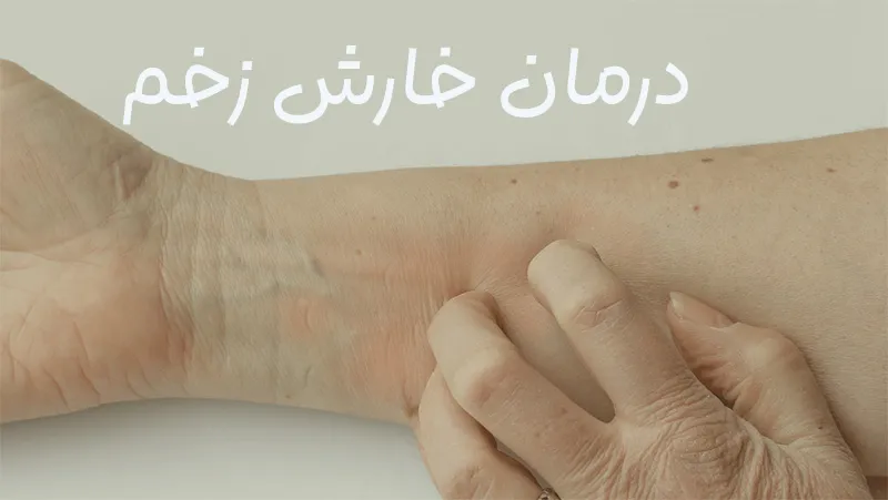 درمان-خارش-زخم