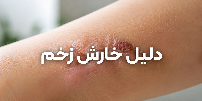 دلایل خارش زخم