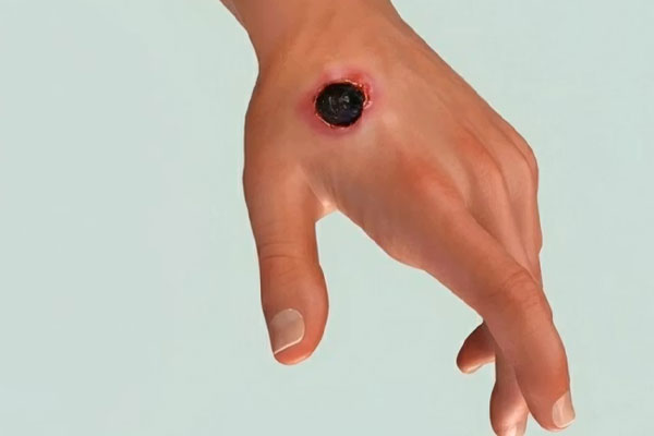 پیگیری‌های پس از درمان