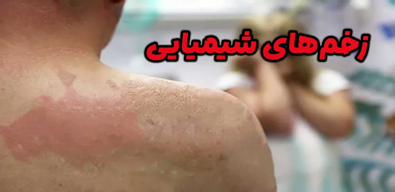 زخم‌های شیمیایی