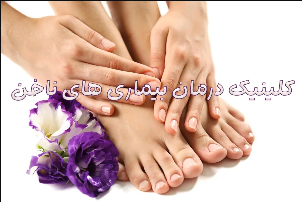 بیماری-ناخن