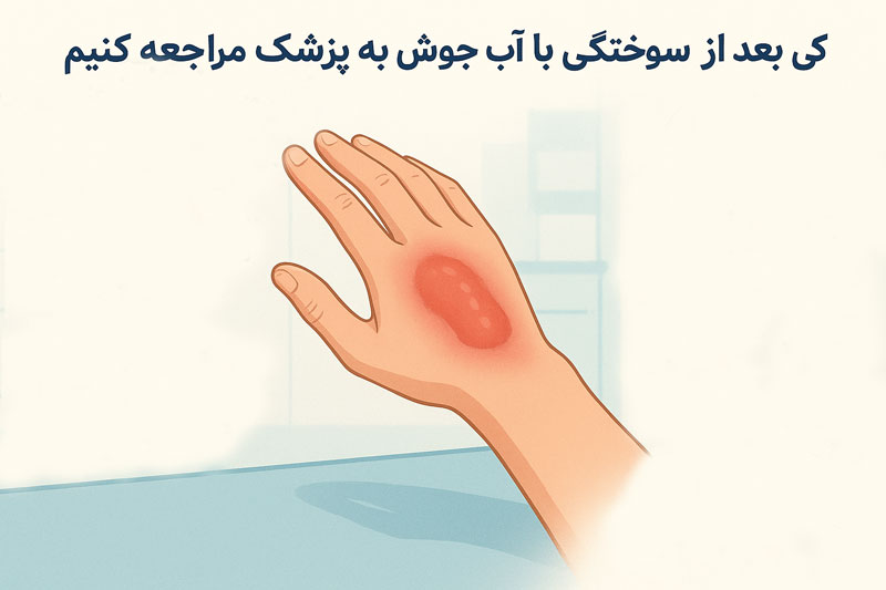درمان سوختگی زخم آب جوش