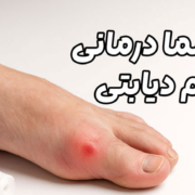 پلاسما درمانی زخم دیابتی