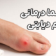 پلاسما درمانی زخم دیابتی