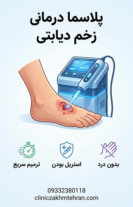 پلاسما درمانی زخم دیابتی