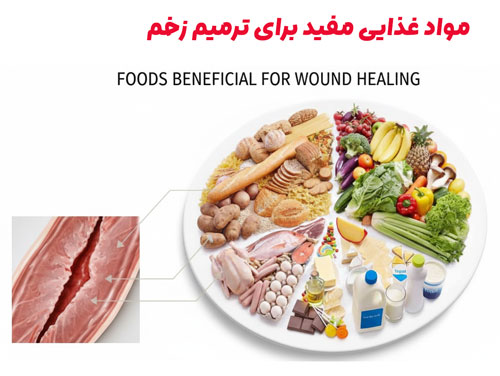 تغذیه ترمیمی ؛ سوخت رسانی هوشمند به بدن برای بهبود سریع  تغذیه ترمیمی ؛ سوخت رسانی هوشمند به بدن برای بهبود سریع