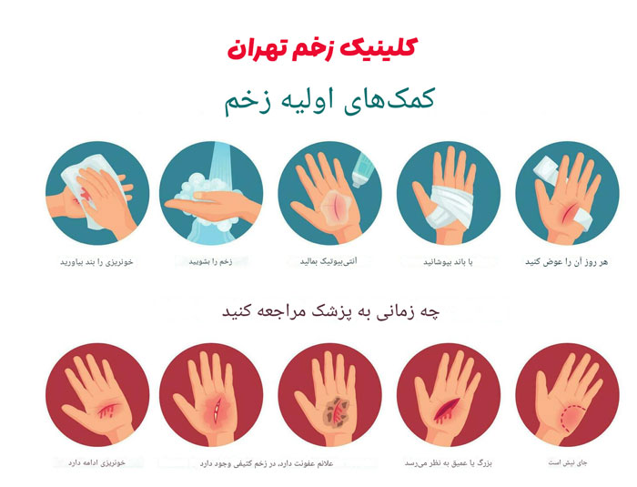 مراقبت های خانگی اصولی برای زخم های باز و عمیق  مراقبت های خانگی اصولی برای زخم های باز و عمیق