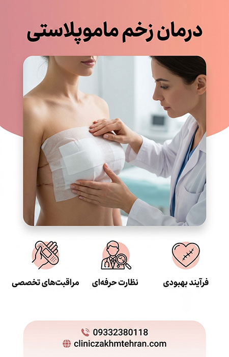 درمان-زخم-ماموپلاستی درمان زخم ماموپلاستی