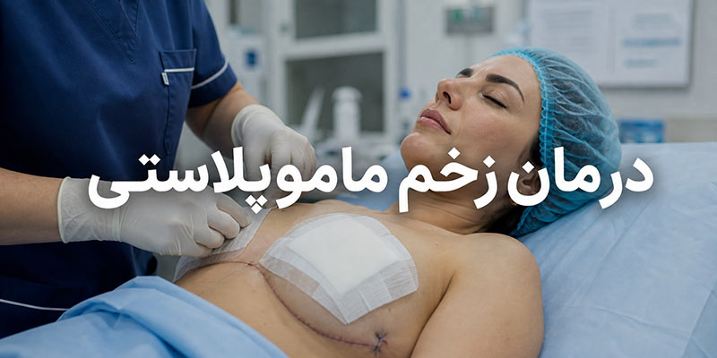 زخم ماموپلاستی