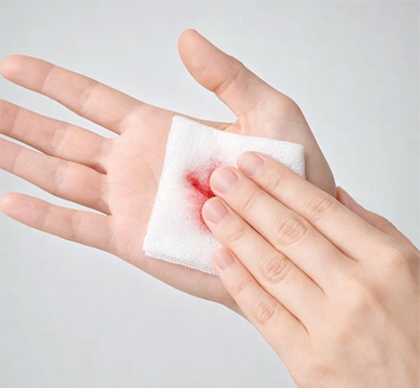 خونریزی زخم و روش های جلوگیری