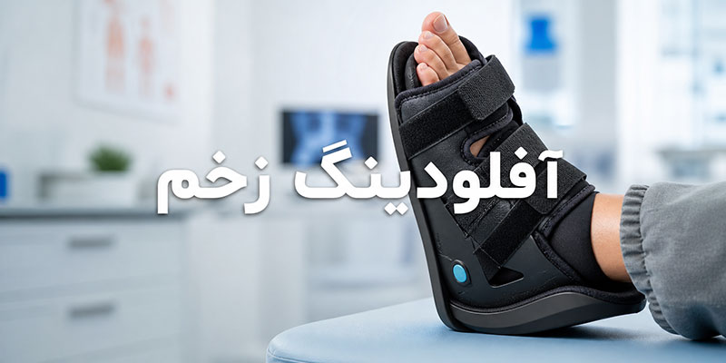 آفلودینگ زخم