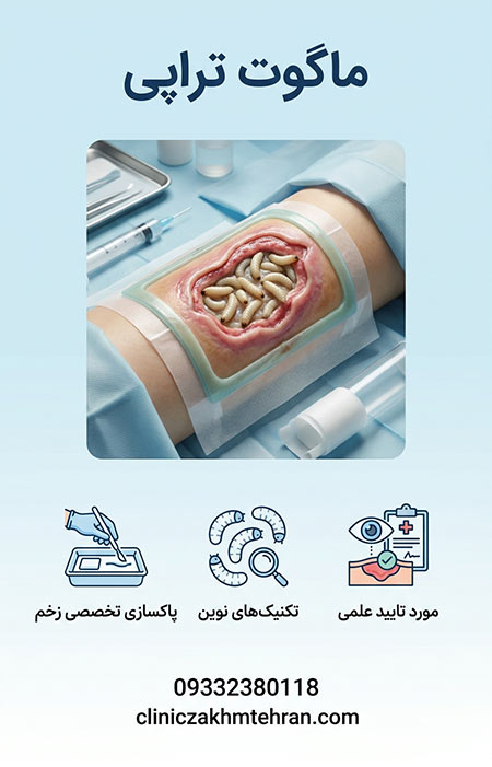 ماگوت تراپی ماگوت تراپی