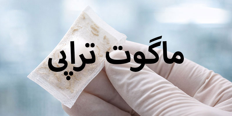 ماگوت-تراپی ماگوت تراپی