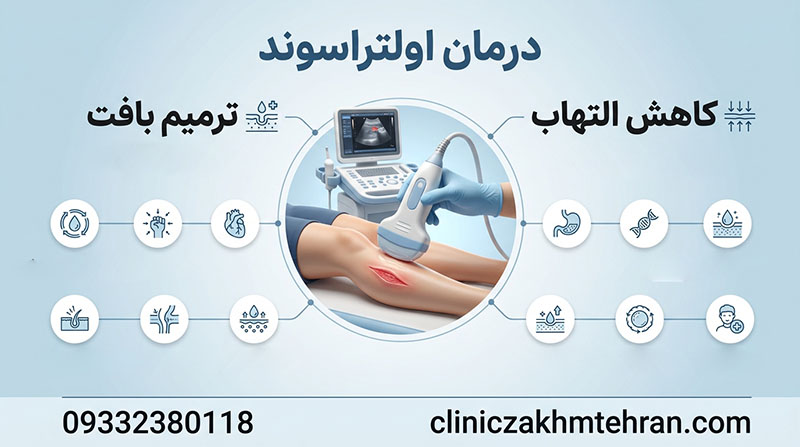 درمان اولتراسوند