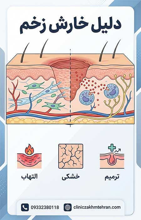 دلیل خارش زخم