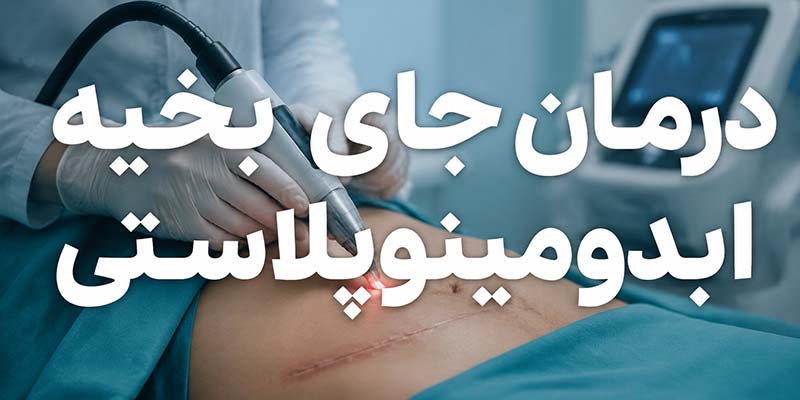 جای-بخیه-ابدومینوپلاستی