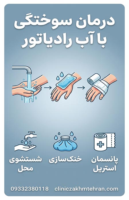 درمان سوختگی با آب رادیاتور