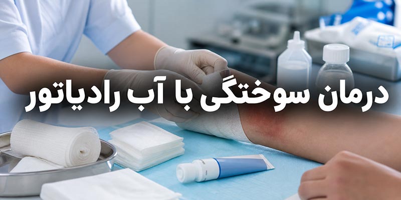 درمان سوختگی با آب رادیاتور