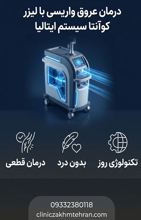 درمان عروق واریسی با لیزر کوآنتا سیستم ایتالیا