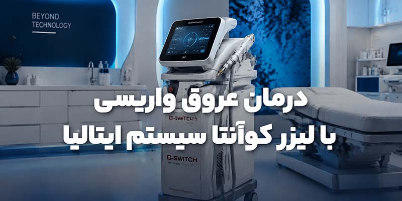 درمان عروق واریسی با لیزر کوآنتا سیستم ایتالیا