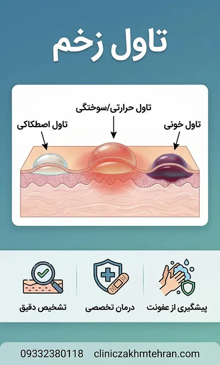 تاول زخم