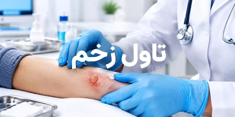 تاول زخم