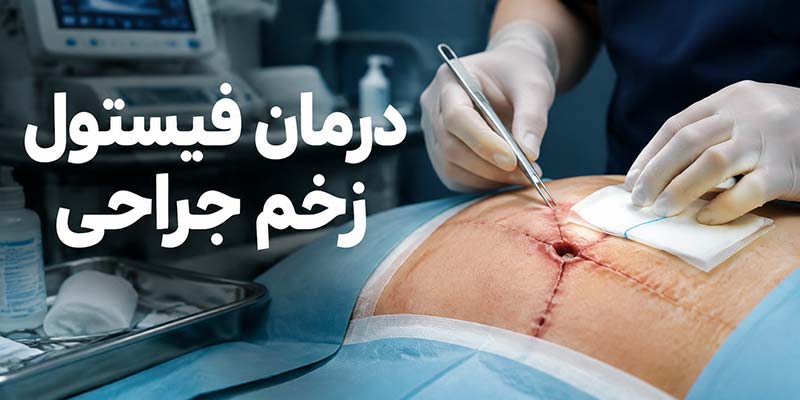 درمان فیستول زخم جراحی