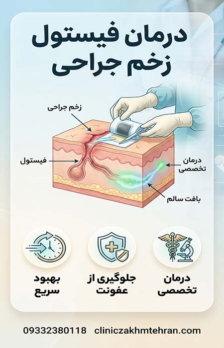 درمان فیستول زخم جراحی