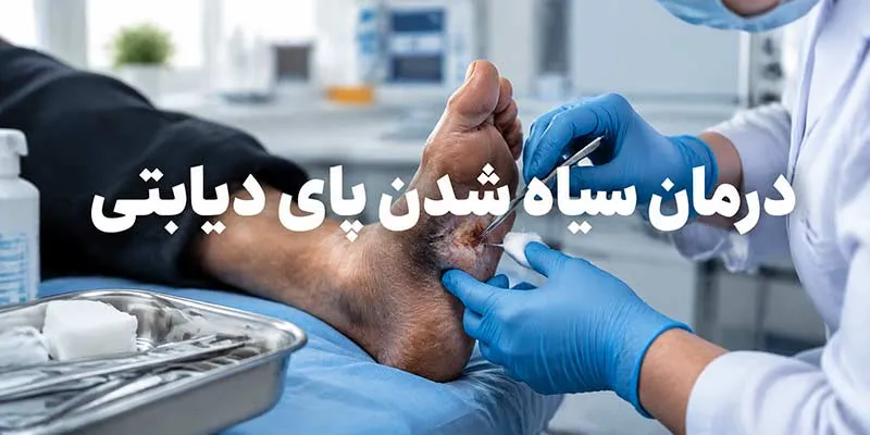 درمان سیاه شدن پای دیابتی