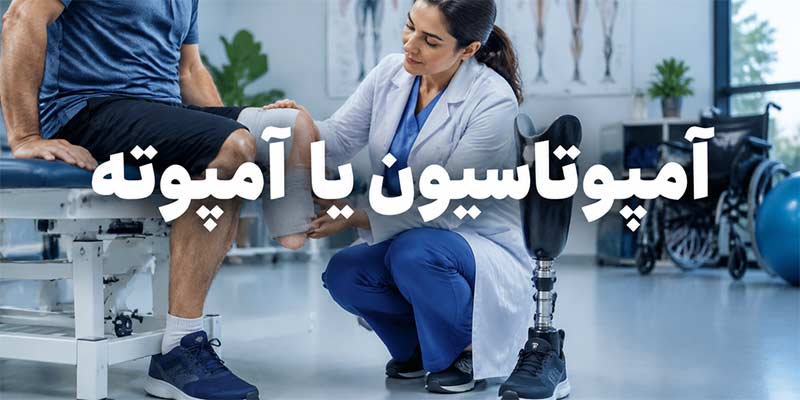 قطع عضو و آمپوتاسیون قطع عضو و آمپوتاسیون