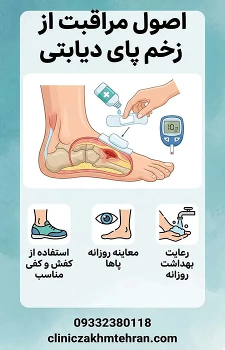 اصول-مراقبت-از-زخم-پای-دیابتی مراقبت از زخم پای دیابتی