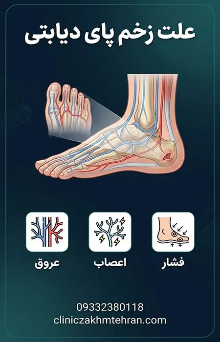 علت زخم پای دیابتی
